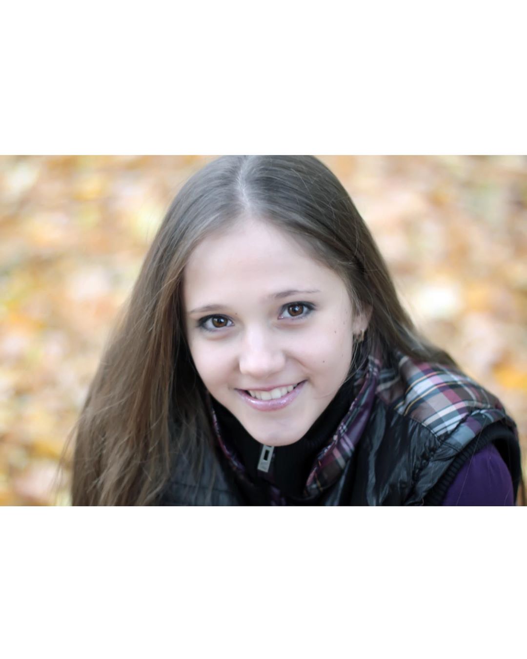 Не узнать: победительница Холостяк-10 показала, как выглядела до пластики губ