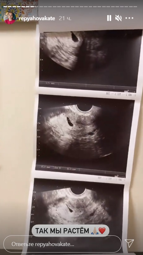 Беременная жена Виктора Павлика поделилась первым фото ребенка