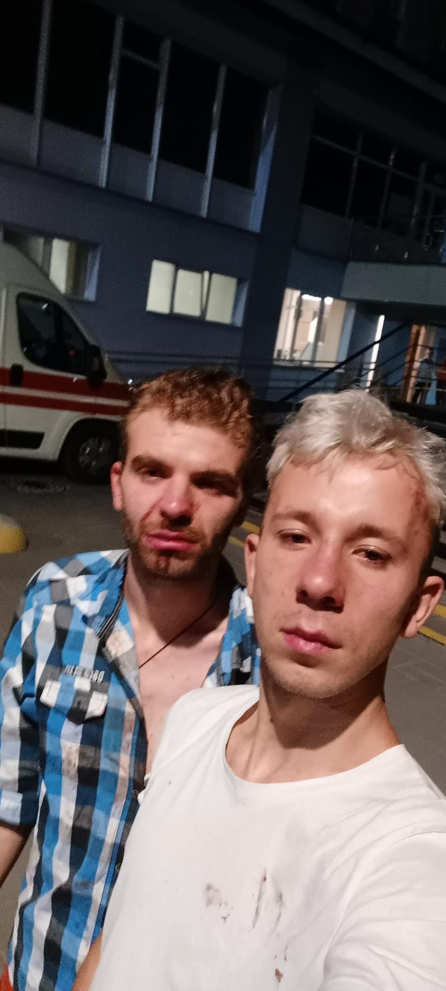 В центре Львова избили уличных музыкантов: подумали, что они из ЛГБТ-сообщества