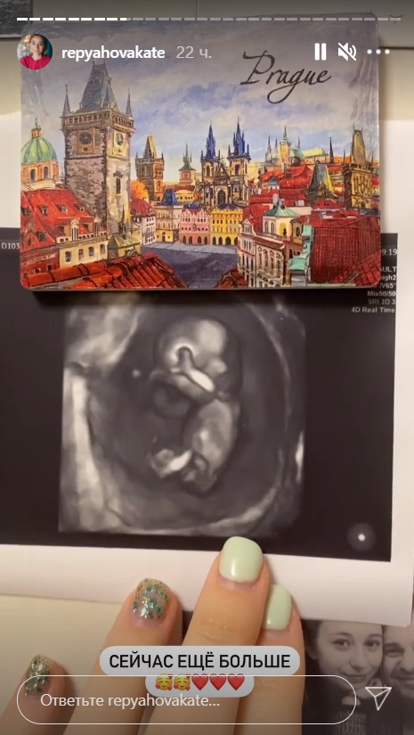 Беременная жена Виктора Павлика поделилась первым фото ребенка