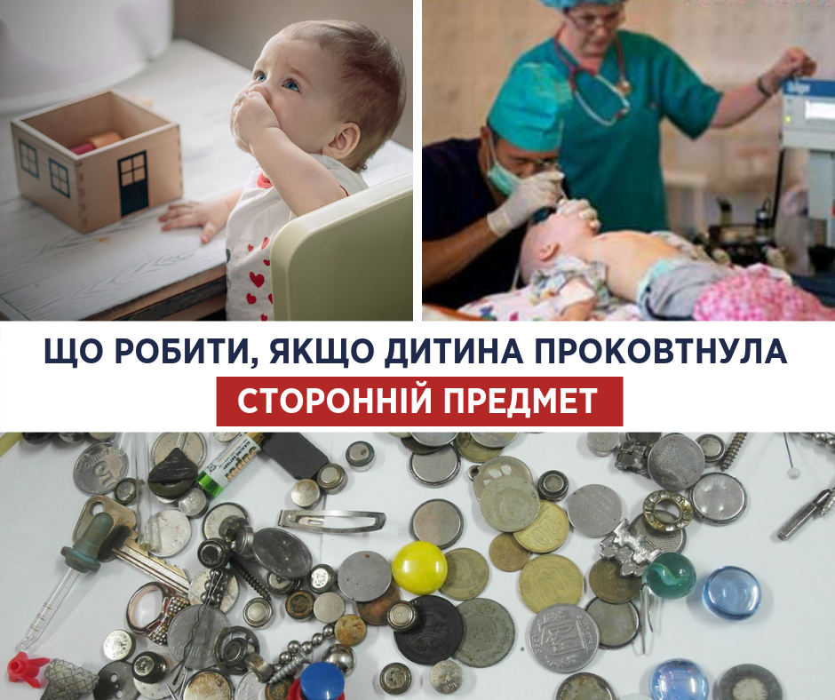 Що робити, якщо діти проковтнули сторонній предмет: Супрун дала відповідь
