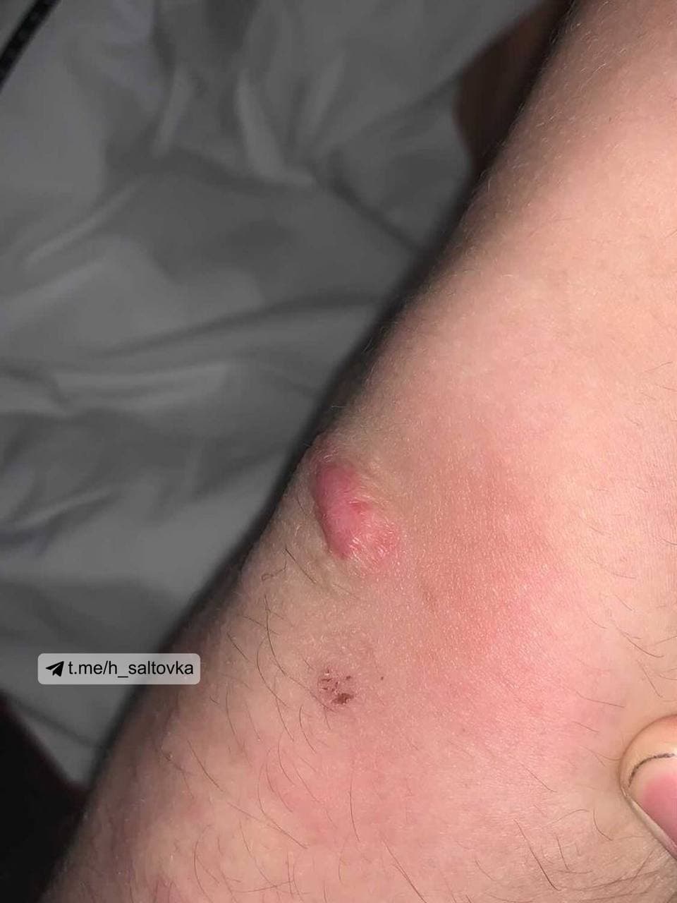 "Укрзализныця" вляпалась в новый скандал: пассажиры пожаловались на укусы