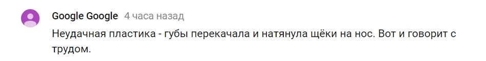 "Говорит с трудом": украинцы были шокированы внешним видом Билык