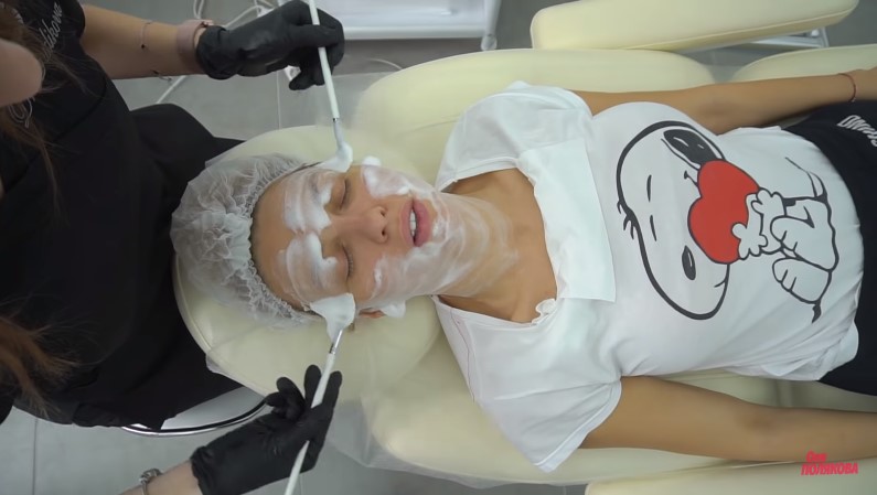 "Колю ботокс": Оля Полякова відверто розповіла про свої б'юті-процедури