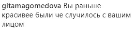 "Что случилось с вашим лицом?": Лорак напугала фанатов внешним видом
