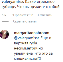 Где Вас так разорвали? Ани Лорак рассмешила фанатов нелепым нарядом