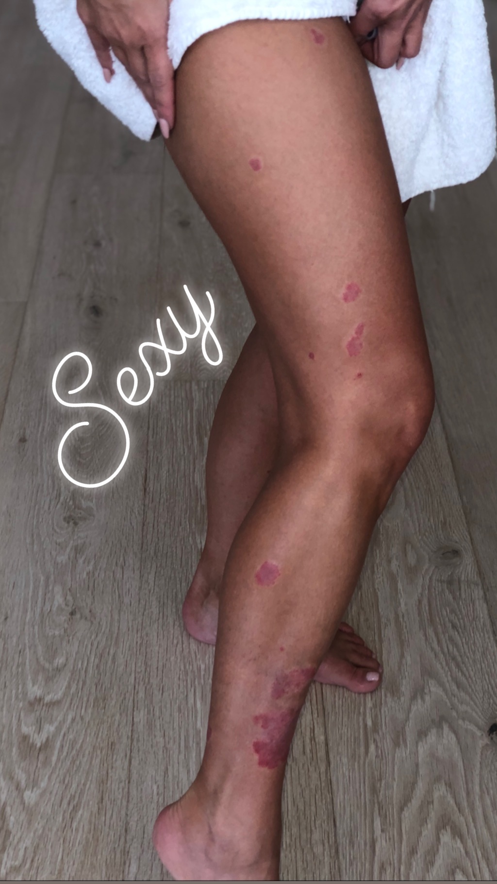 Смілива й відверта: Кім Кардашьян не побоялася показати недоліки шкіри (фото)