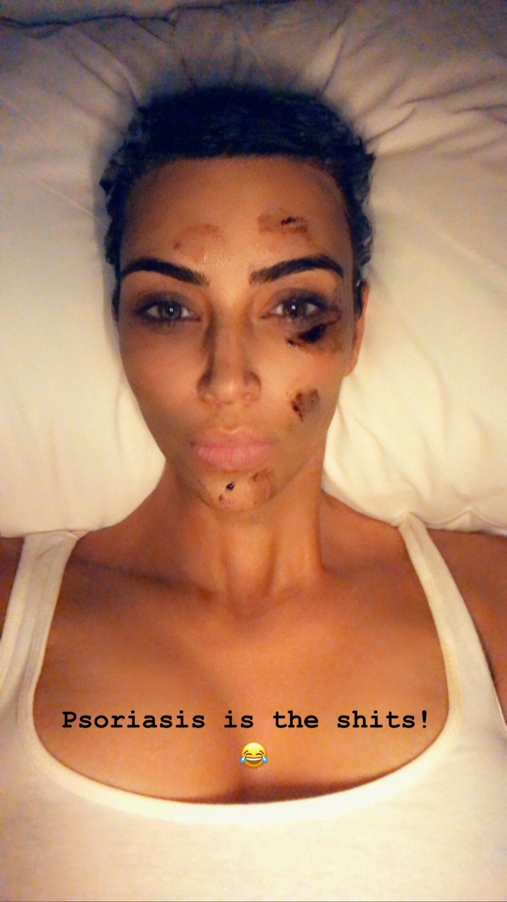 Смілива й відверта: Кім Кардашьян не побоялася показати недоліки шкіри (фото)