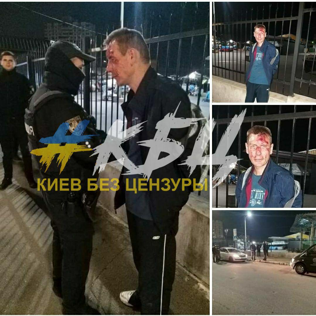 У Києві пенсіонерка жорстко покарала злодія: "трошки" побитий (фото)