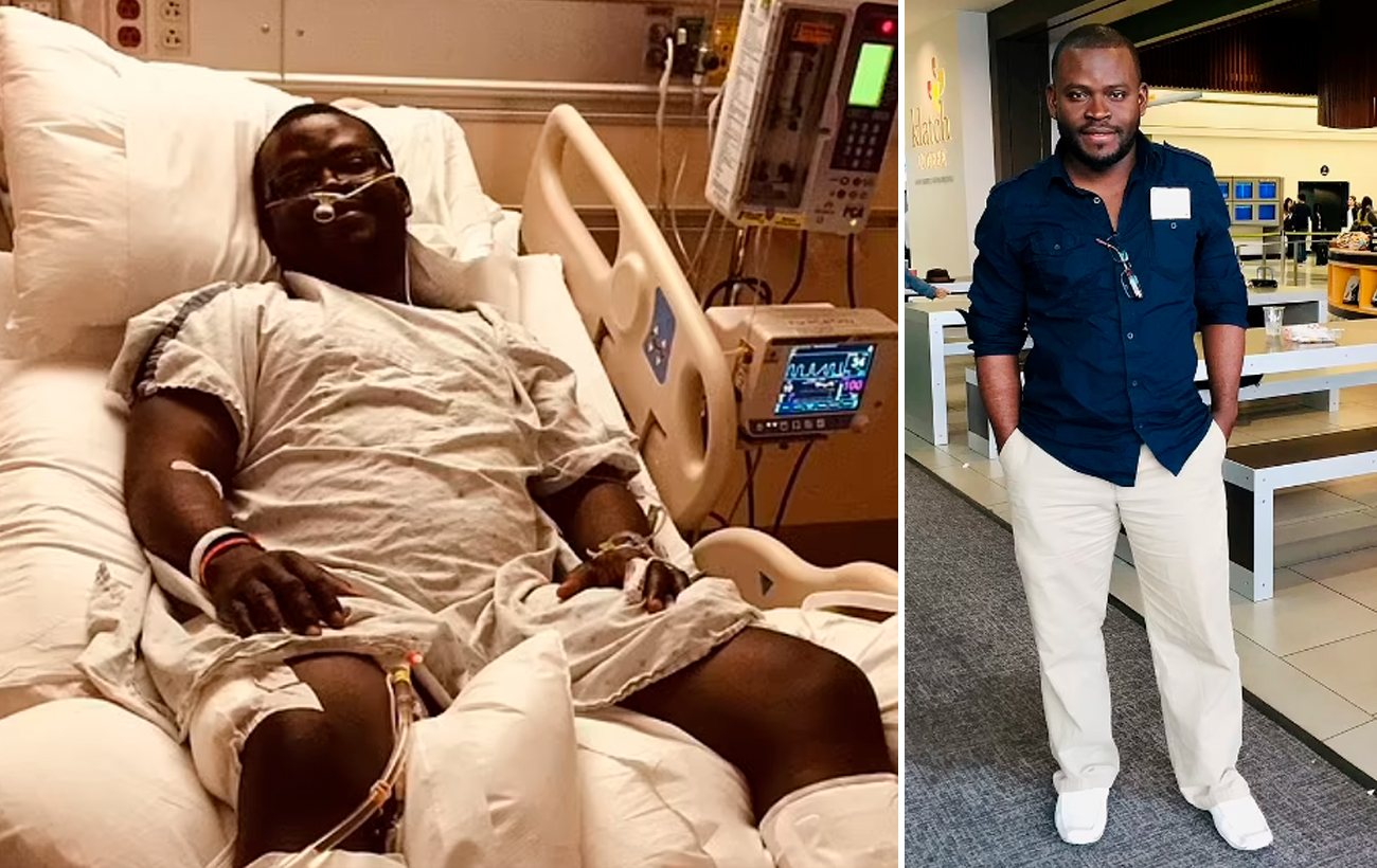 Мужчина сломал себе обе ноги, чтобы сходить на свидание (фото)