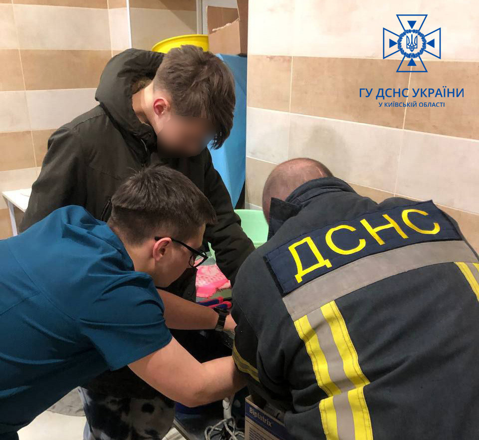 Под Киевом парень не мог снять кольцо от фонарика с пальца: видео спасения