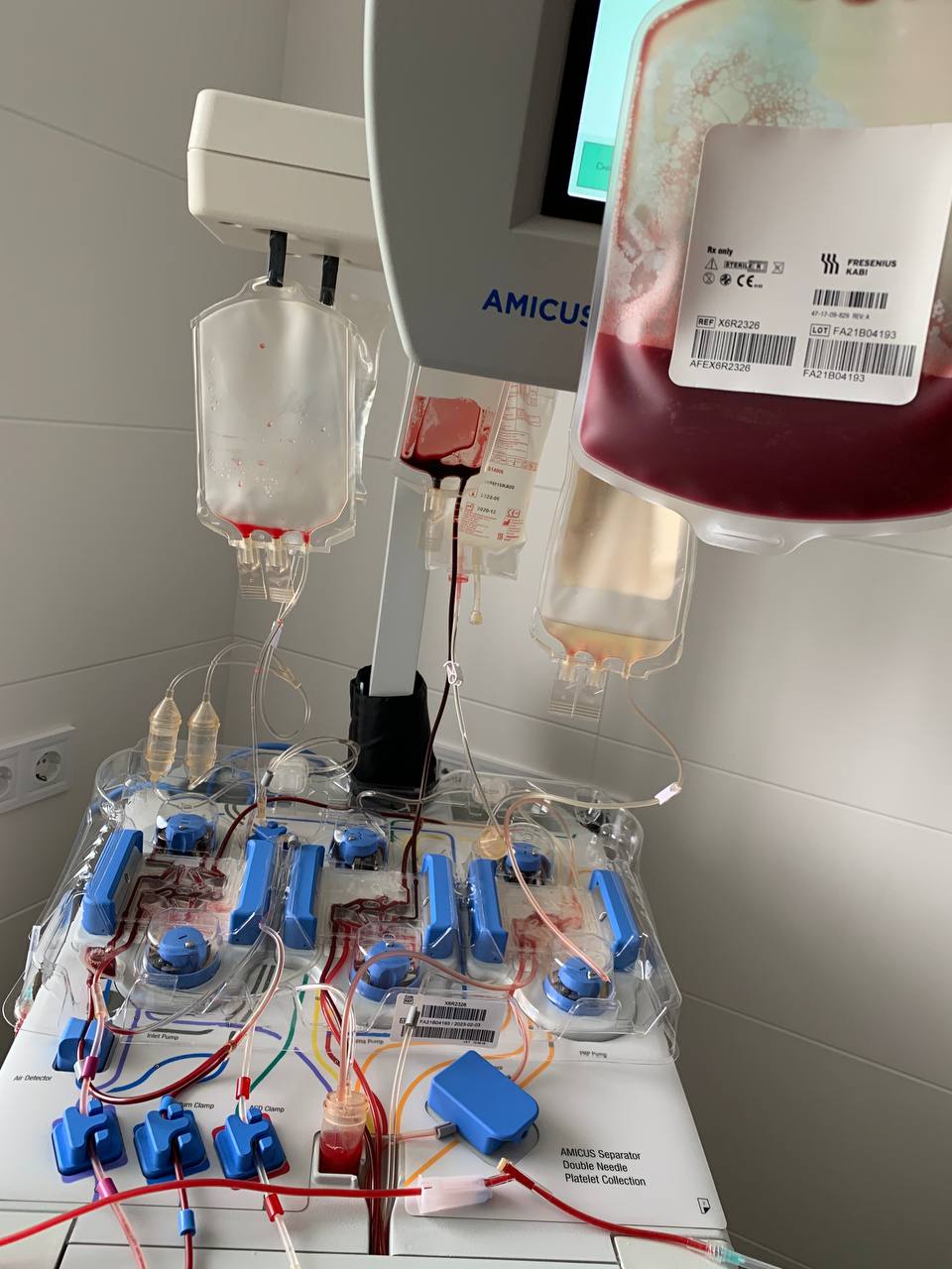 Львівські лікарі розкрили деталі першої унікальної операції: "маленький герой зовсім не боявся"