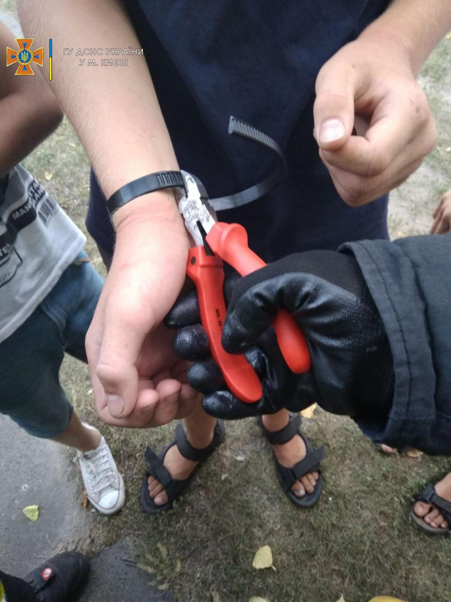 У Києві рятувальники допомогли підлітку звільнитися від небезпечних "прикрас"