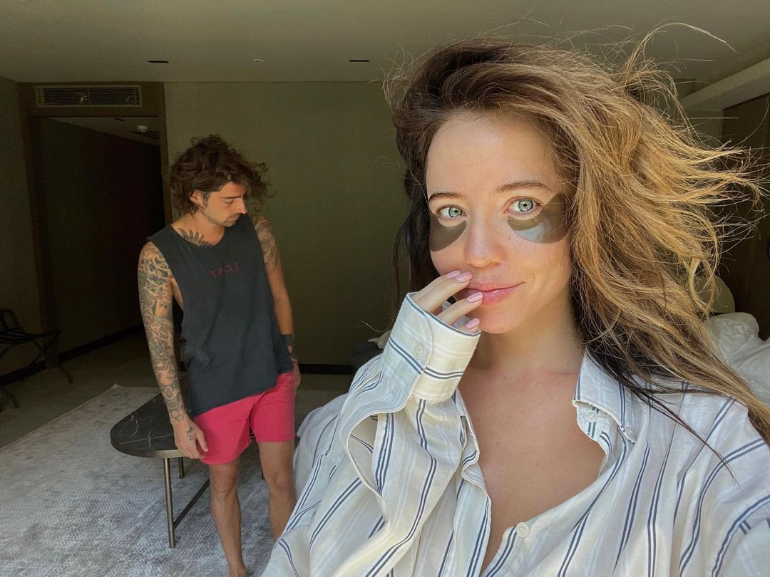 Телеэкран vs реальность: Оля Полякова, Лилия Ребрик, Настя Каменских и другие звезды без макияжа