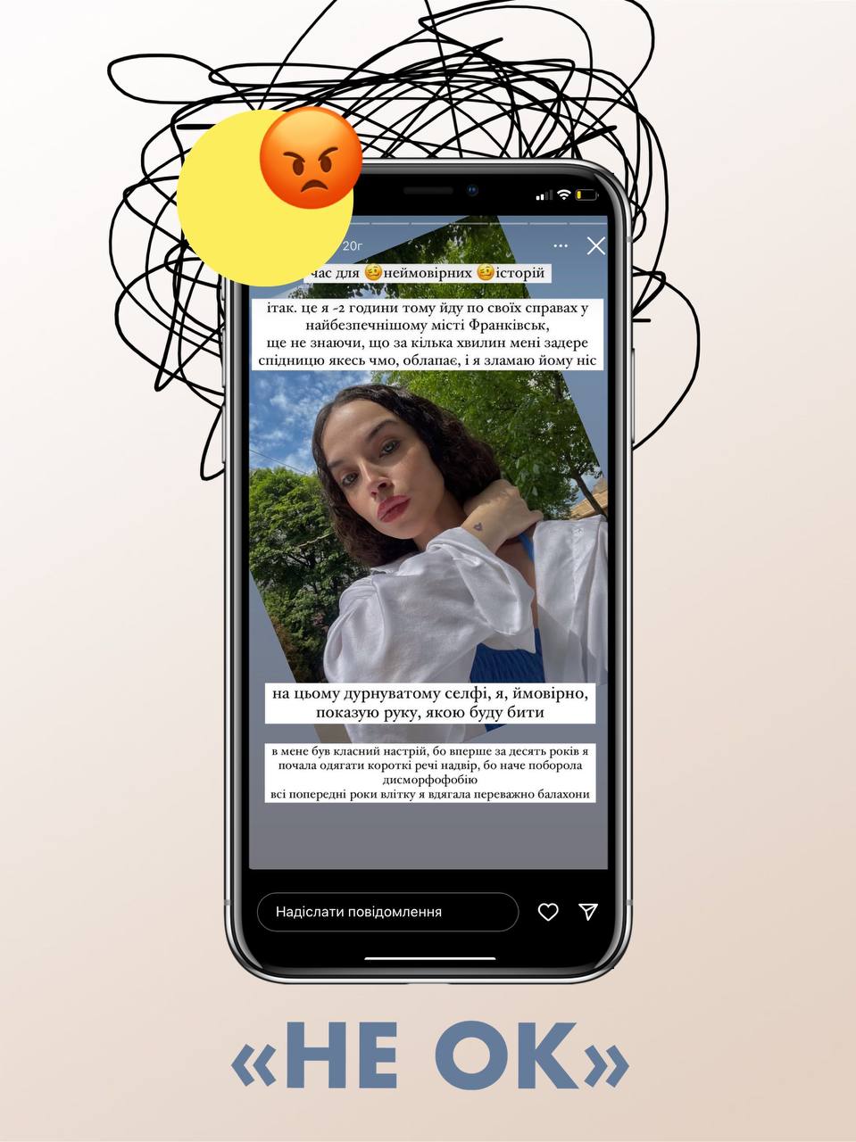 В Івано-Франківську дівчина зламала ніс чоловіку, який "облапав" її в черзі. Люди стали на захист кривдника