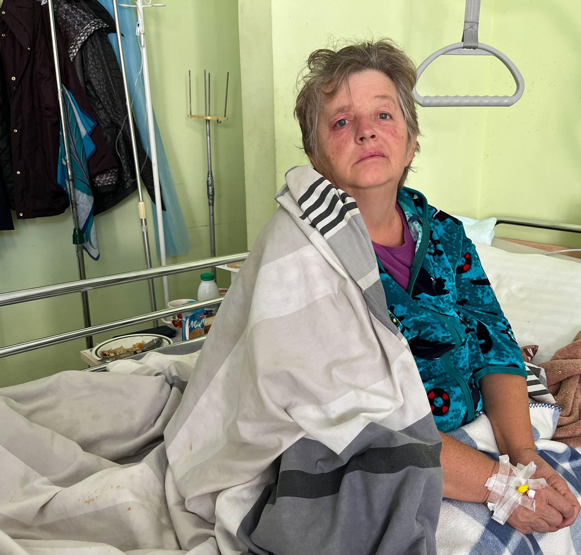 Ни одного разреза: украинские медики спасли жизнь женщине с огромной аневризмой