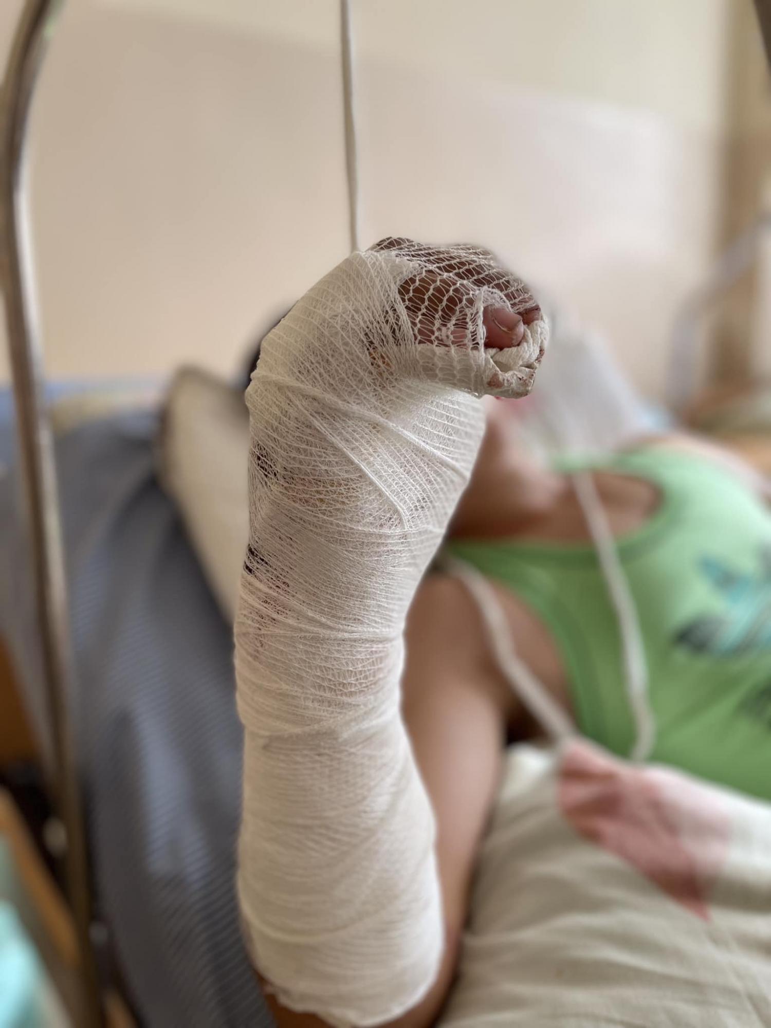 Впервые работали с такой сложной травмой: во Львове врачи чудом спасли парню руку