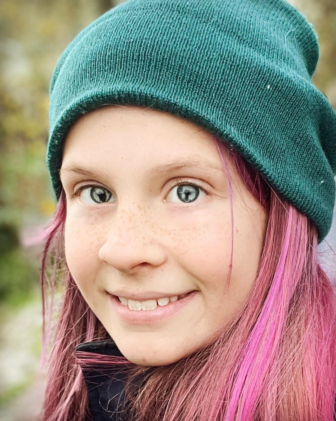 Ось як виглядають люди з генетичним дефектом очей, який робить погляд "зміїним"