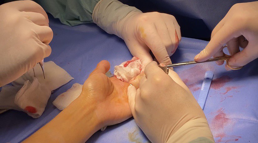 У украинки обнаружили редкую патологию: такого не видели даже врачи Оксфорда! (фото)