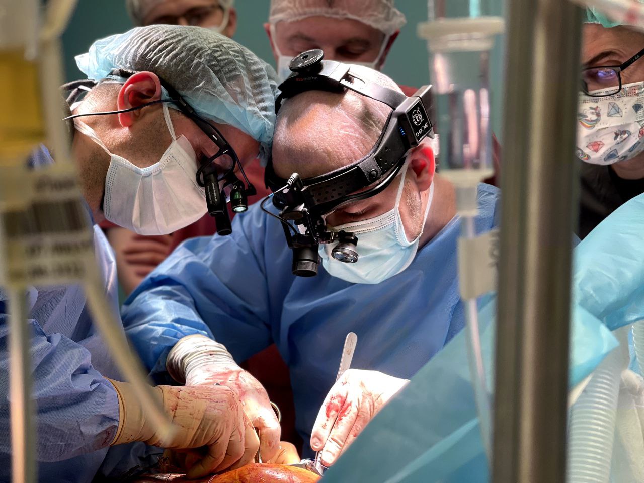 Українські лікарі вперше пересадили легені ліквідатору аварії на ЧАЕС (фото)