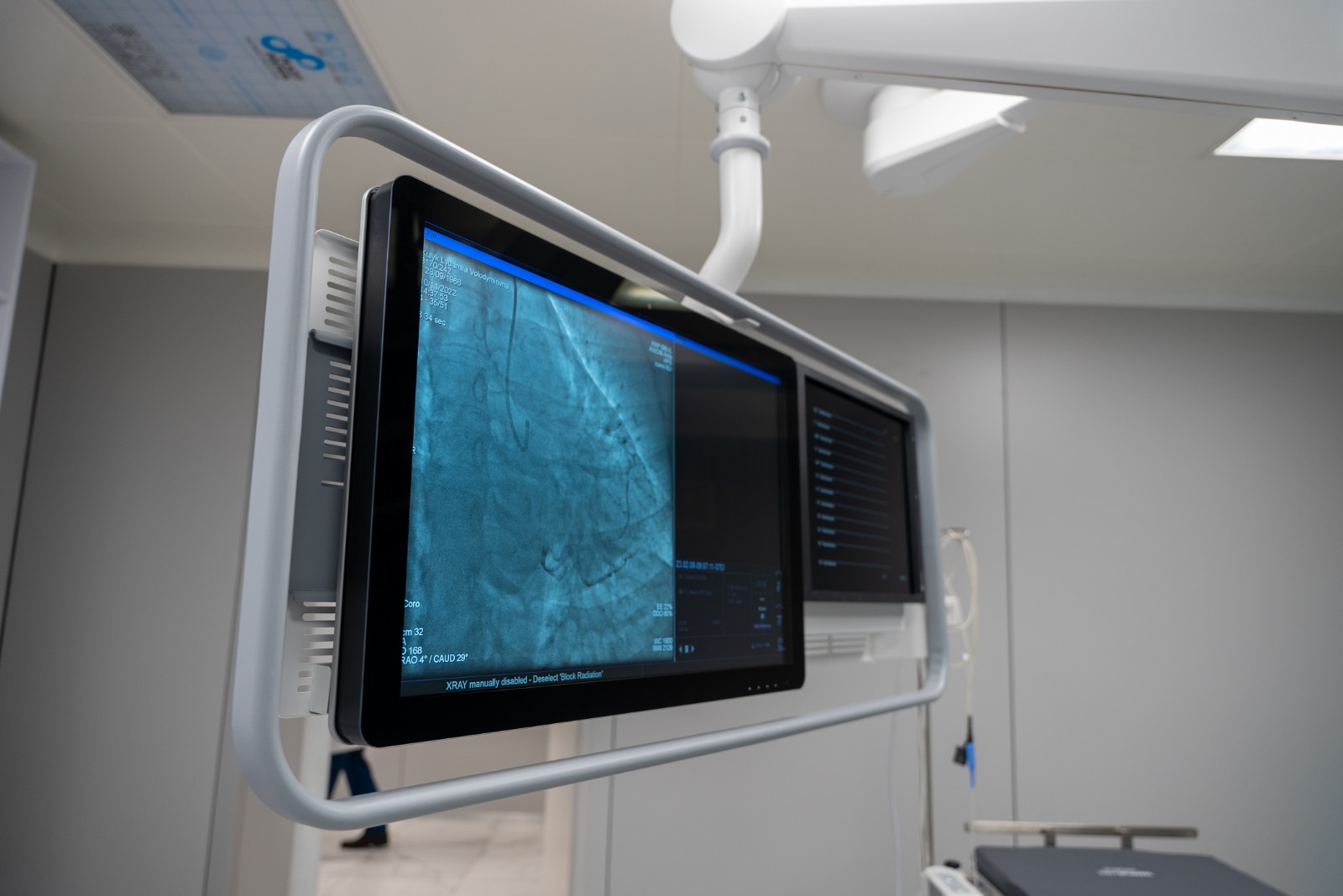 У лікарні під Києвом встановили новітнє обладнання, яке рятуватиме життя (фото)