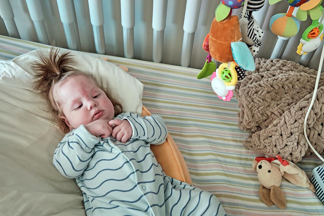 В Охматдиті врятували малюка з роз'єднаним стравоходом: Ростик вперше почав їсти у 7 місяців