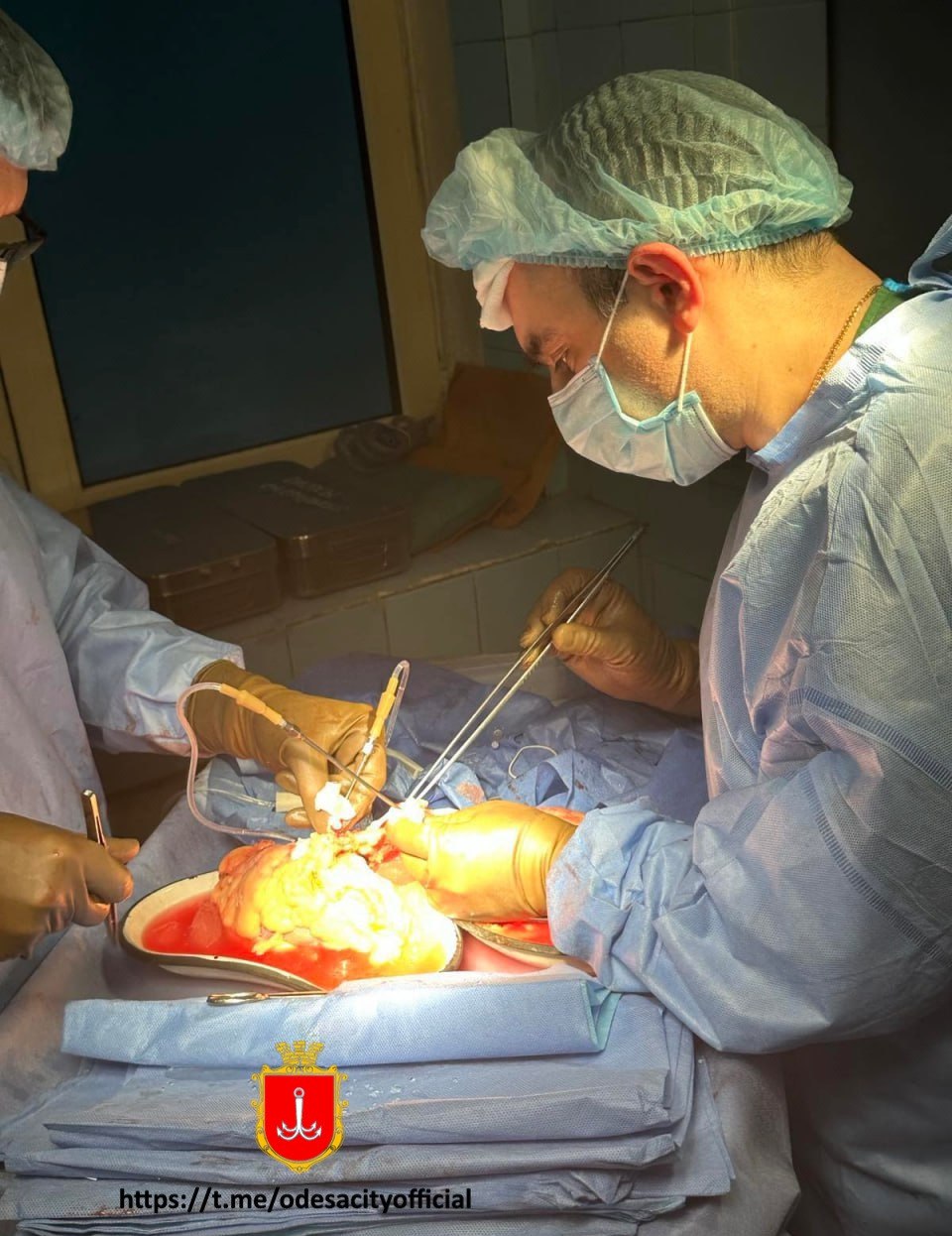 В Одессе впервые пересадили сердце: как прошла сложнейшая операция (видео и фото)