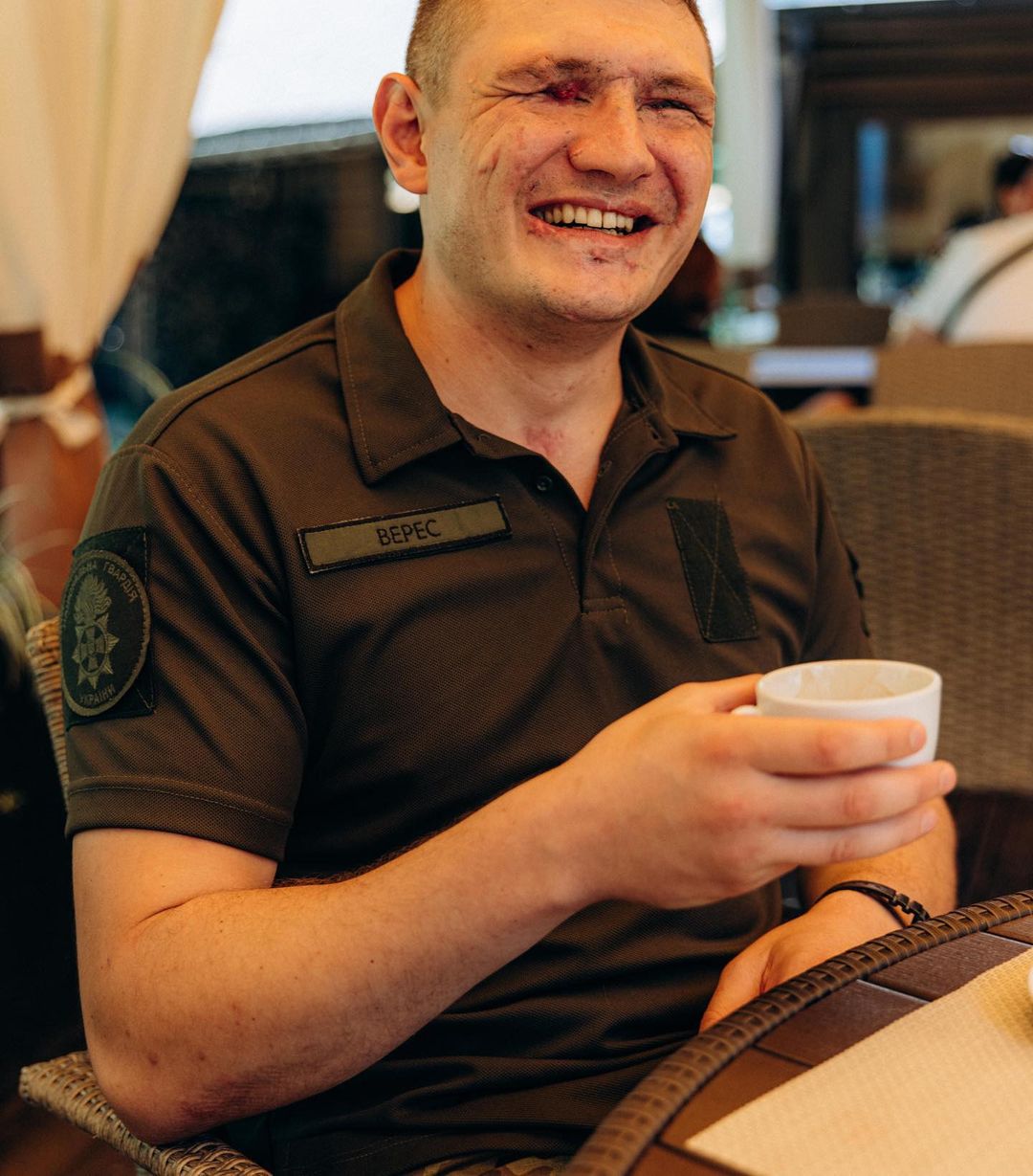 "Антитіла" попали в громкий скандал с незрячим воином ВСУ: все детали