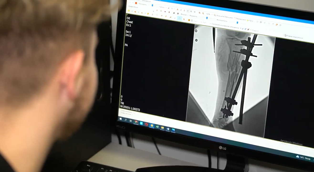 "Родным сказали, что я погибла": во Львове спасли жизнь женщине из Бахмута