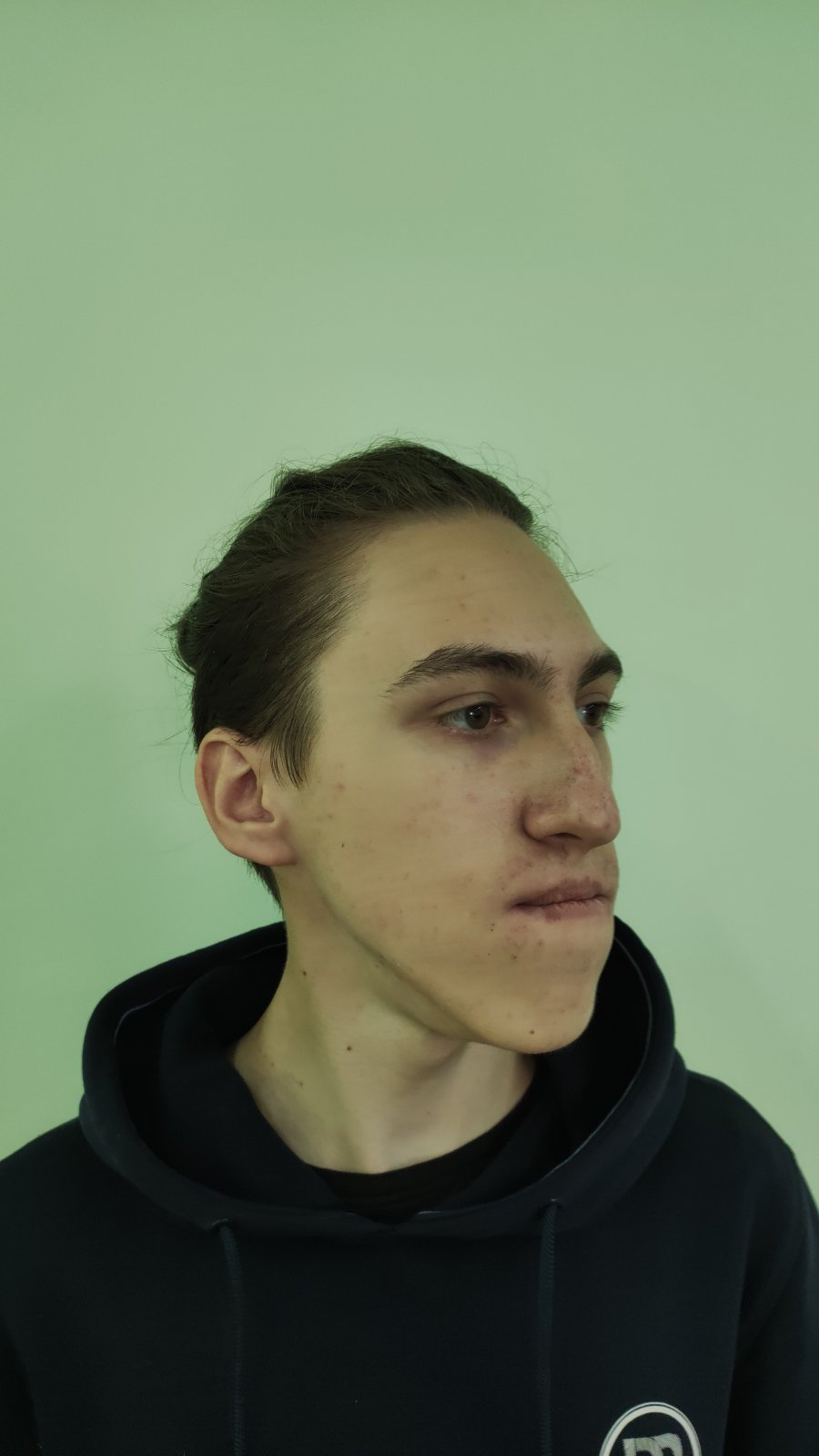 "Сложили, как кубики лего": во Львове реконструировали лицо парню с тяжелым пороком