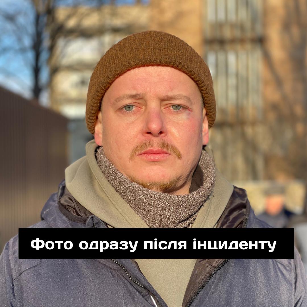 Прямо в театрі. В Дніпрі побили українського актора, поліція не реагувала