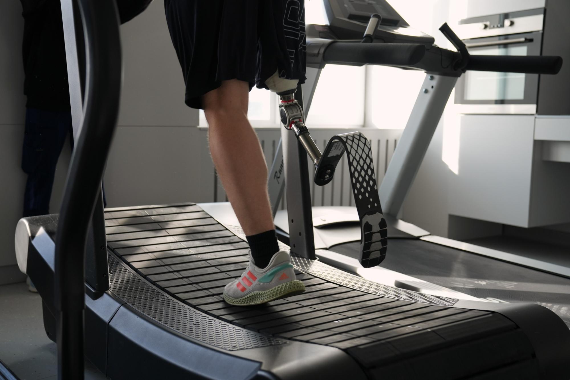 Сможет бегать на протезе. Львовские медики осуществили мечту раненого воина