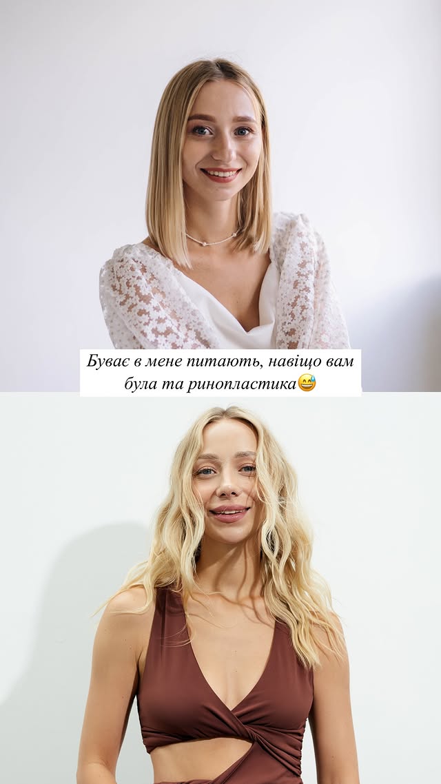 Жена Виктора Павлика похвасталась новым лицом после "пластики": как она выглядит