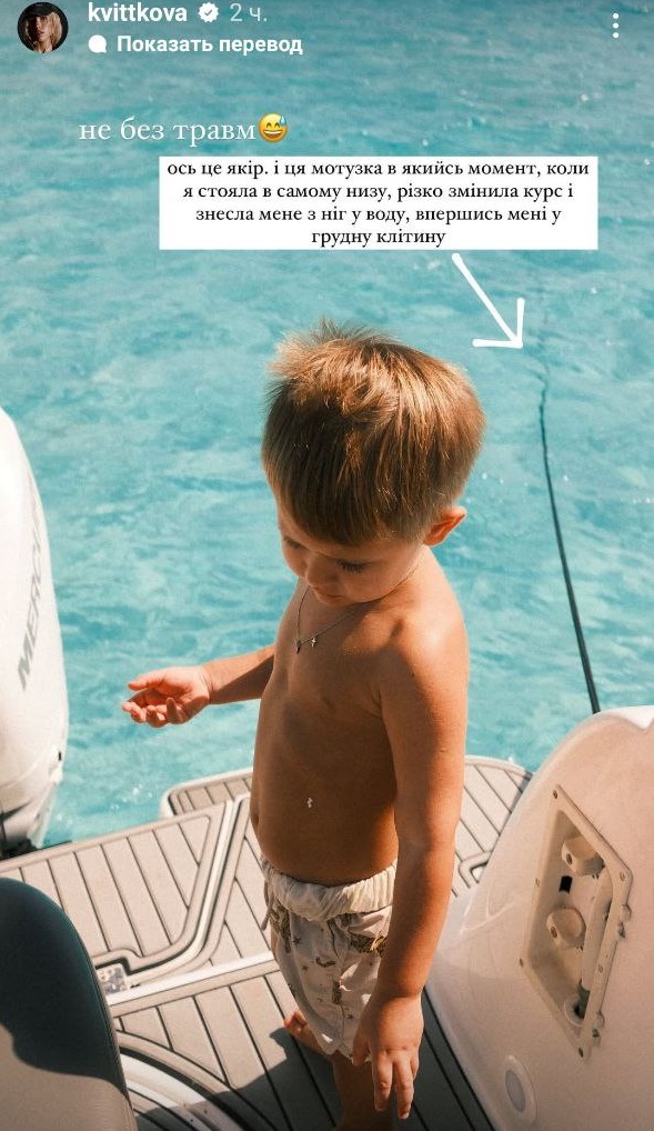 Даша Квіткова отримала травму під час шикарного відпочинку на яхті в Домінікані: фото наслідків