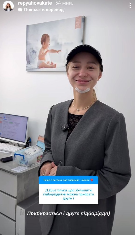 Жена Виктора Павлика похвасталась новым лицом после "пластики": как она выглядит