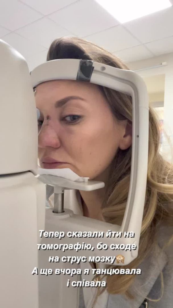 Зірка "Квартала 95" Саліванчук жахнула фото після перелому носа і струсу мозку