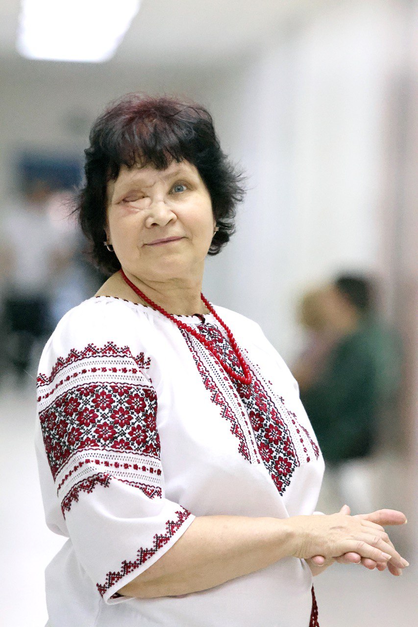 Олена Свєтлова, пацієнтка проєкту "Незламна краса" Ще більше можливостей повертати красу українцям, чиї обличчя понівечила війна!