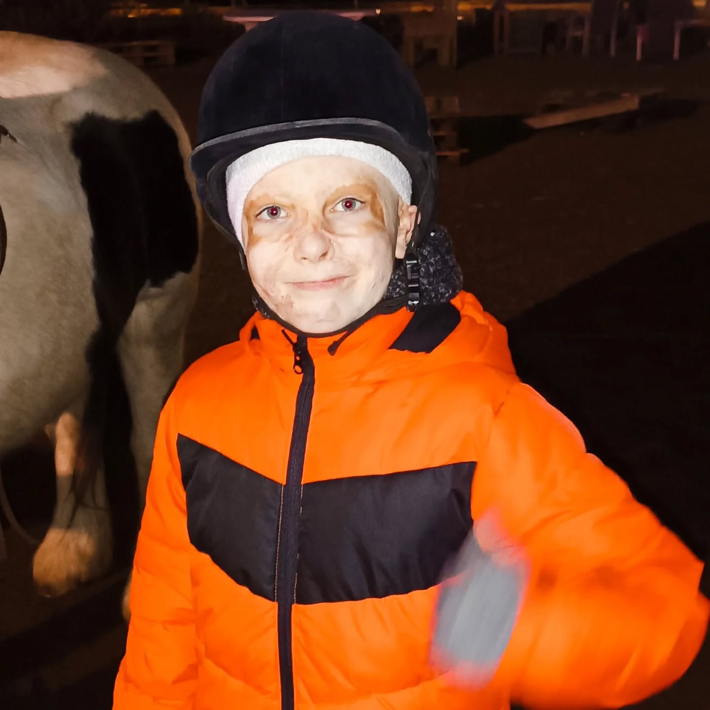 Маска залишиться спогадом. Хлопчик, який дивом вижив після ракетного удару в Вінниці, знову танцює