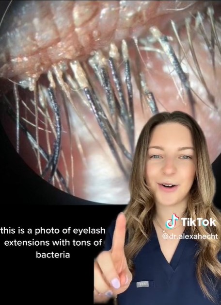 Окуліст показала відео, після якого вам більше не захочеться нарощувати вії