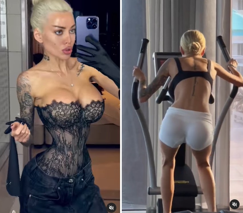 Взгляните, что случилось с "украинской Кардашьян": снова легла под нож и теперь соблазняет иностранцев