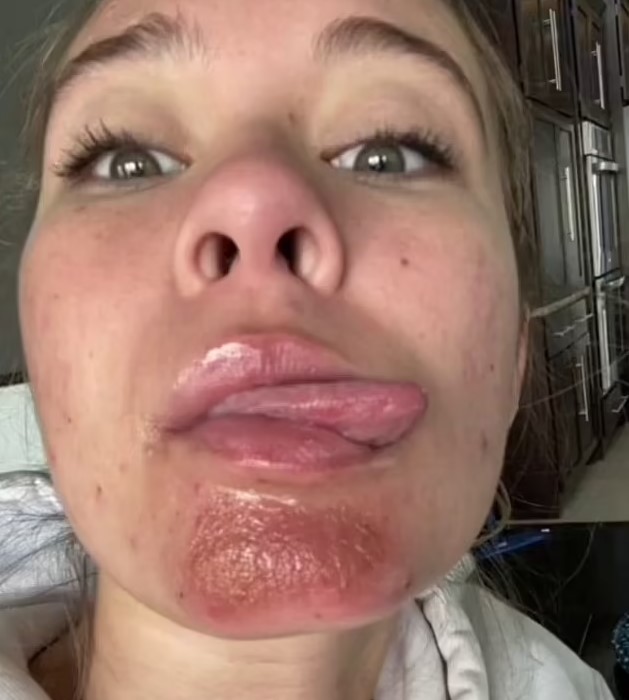 Вот почему отношения с бородатыми мужчинами могут быть опасны