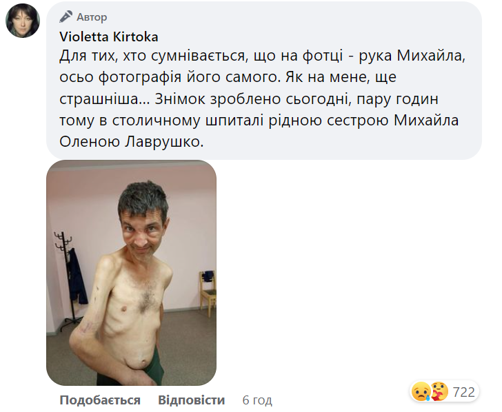 Украинцы за несколько часов собрали миллионы на лечение героя "Азовстали" Дианова