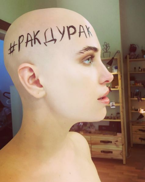 Вони змогли: 5 українських зірок, які побороли рак