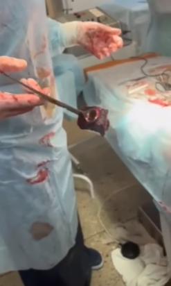 "Из живой ткани идет дым": в Днепре врачи спасают парня с тяжелым ранением