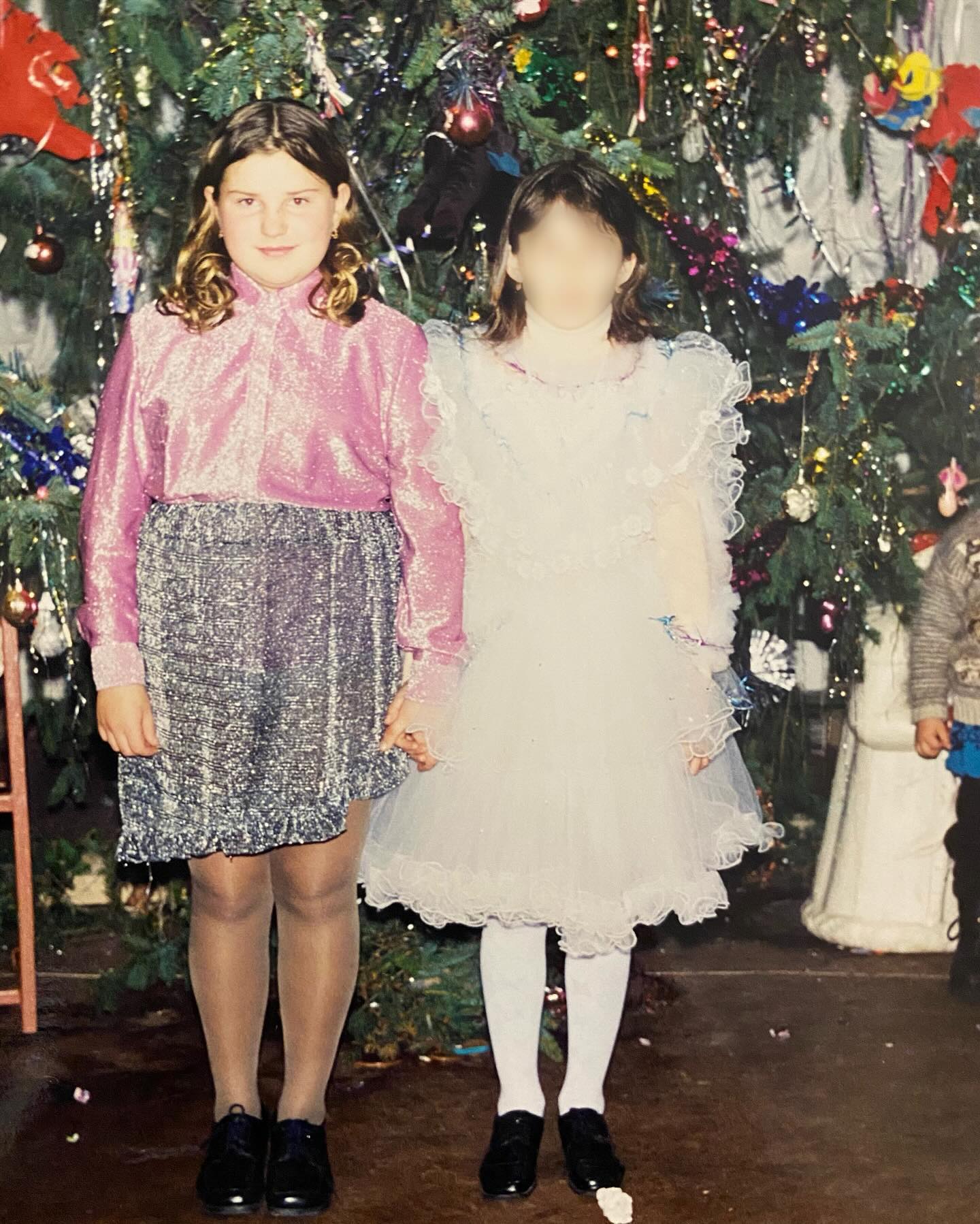 Alyona Alyona згадала, як у дитинстві її булили батьки через зайву вагу: "Ну може не їж ти вже, га?"