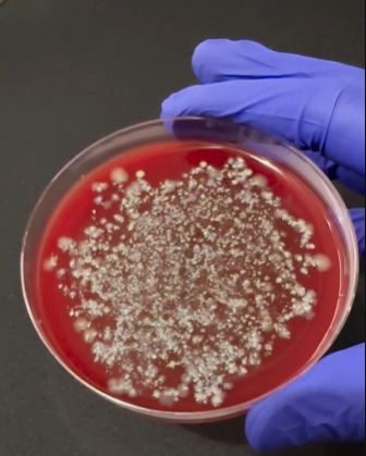 Сколько микробов на суши. Ученый показал то, что трудно "развидеть" (видео)