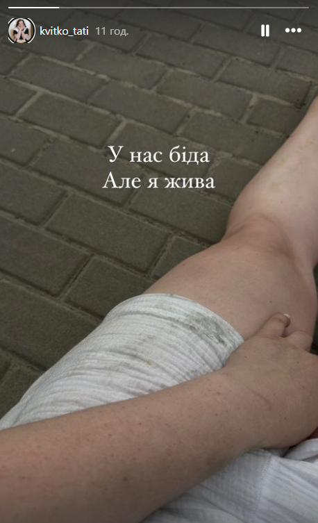 "Не все живы": участница "СуперМамы" сообщила о потере родного человека из-за пожара в доме