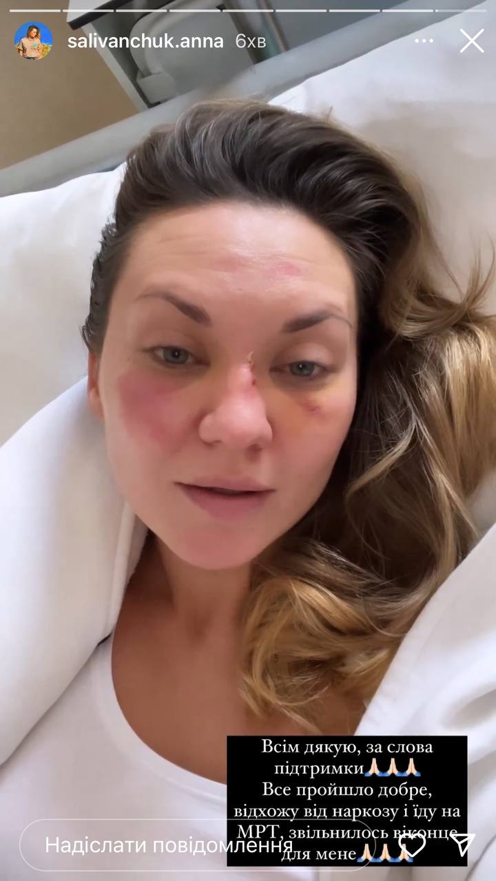 "У моїй голові два затемнення": акторці Саліванчук після жахливого падіння зробили операцію