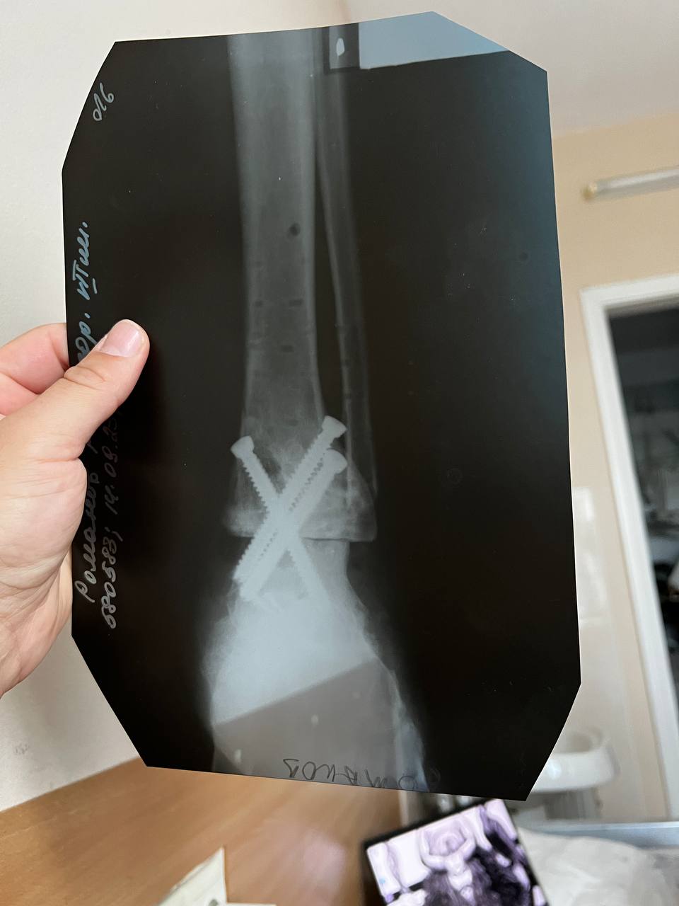 "Росія хоче, щоб ми всі покинули рідну країну і забули свою історію". Доброволець ЗСУ дивом вижив після поранення