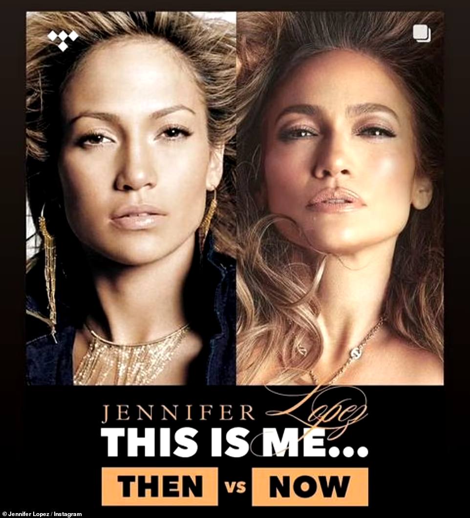 Джей Ло показала, як за 20 років змінилась її шкіра: така як всі